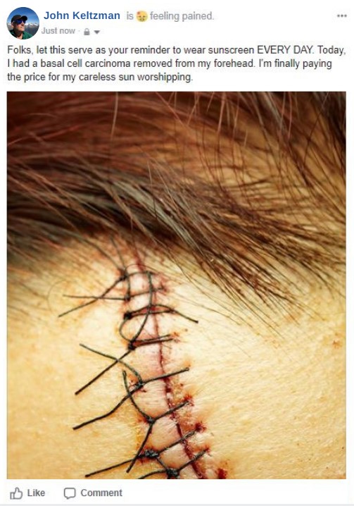 do-i-have-skin-cancer