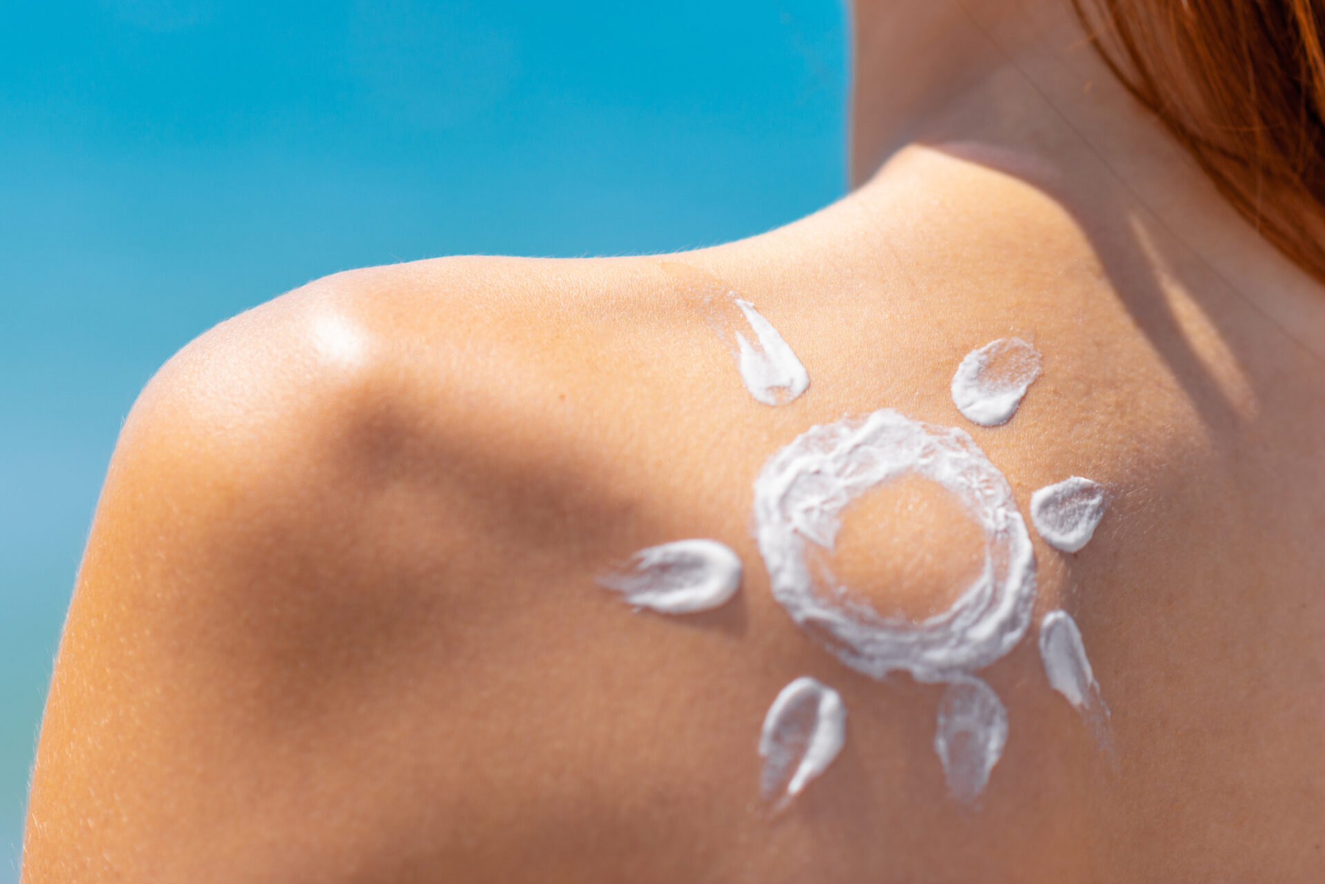 Sol hecho con crema en el hombro.