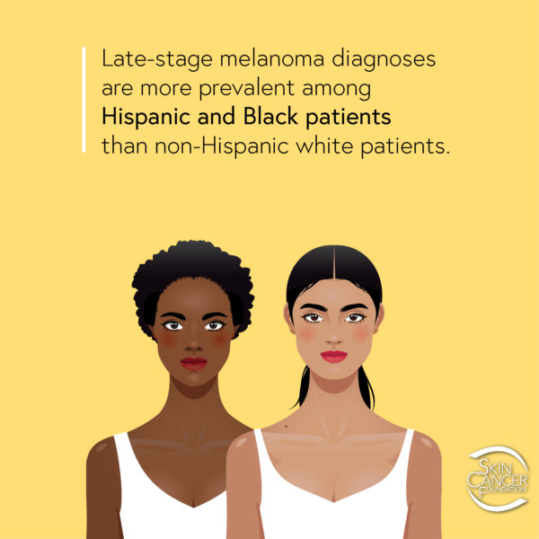 SkinofColorFact3 Late-stage melanoma diagnoses are more prevalent among Hispanic and Black patients than non-Hispanic white patients