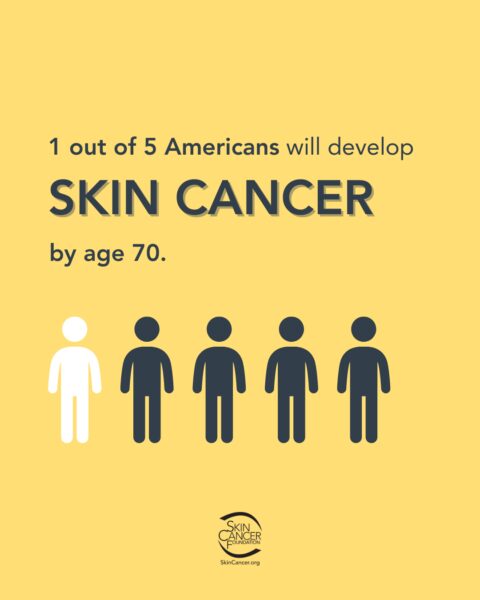 skin-cancer-statistics-infographic A visual representation of the statistic that 1 in 5 Americans will develop skin cancer by age 70, featuring 5 figures, with one in white and the rest in dark blue, and the Skin Cancer Foundation logo.