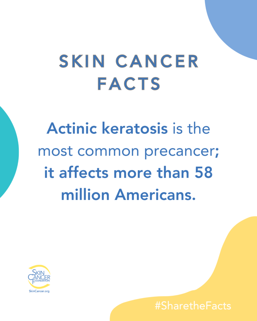 skin-cancer-facts-actinic-keratosis.jpg Skin Cancer Facts: Actinic keratosis is the most common precancer; it affects more than 58 million Americans. #SharetheFacts.