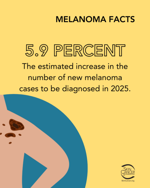 melanoma fact increased case